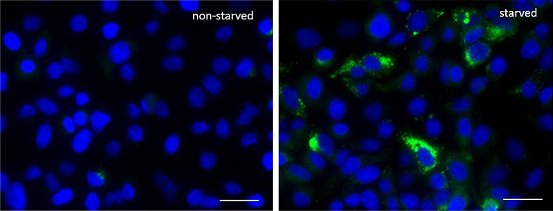 Autophagy Detection Probe Green Reactivity: Human Size: 1 vial