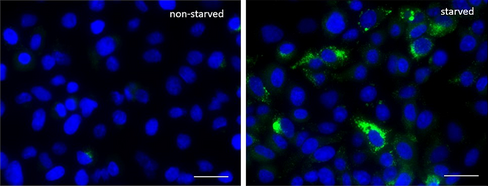 Autophagy Detection Probe Green Reactivity: Human Size: 1 vial