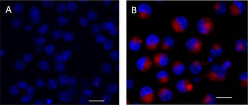 Cellular Senescence Kit Red Reactivity: Mouse, Human Size: 100 test