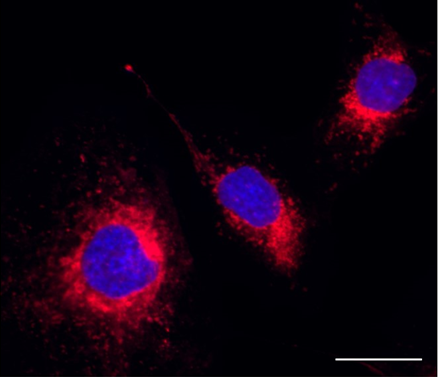 Endoplasmic Reticulum Probe Red Reactivity: Human Size: ea