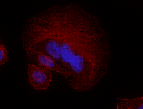 Flash Phalloidin(TM) Red 594 Reactivity: Human, Mouse, Rat, All Species Size: 300 units
