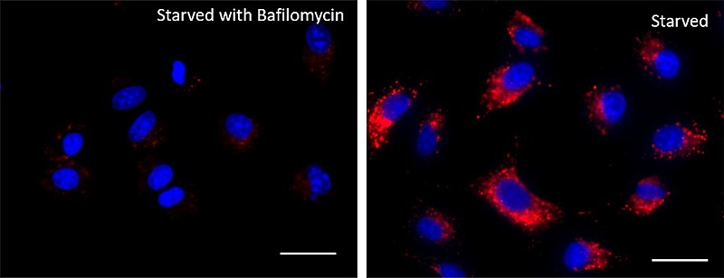 Lysosome Probe Deep Red Reactivity: Human, Mouse Size: 1 vial