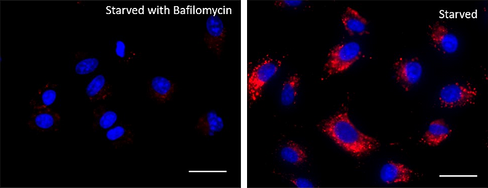 Lysosome Probe Deep Red Reactivity: Human, Mouse Size: 1 vial