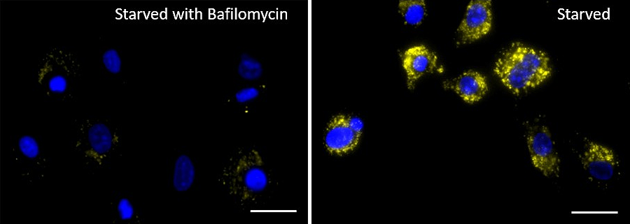 Lysosome Probe Orange Reactivity: Human, Mouse Size: 1 vial