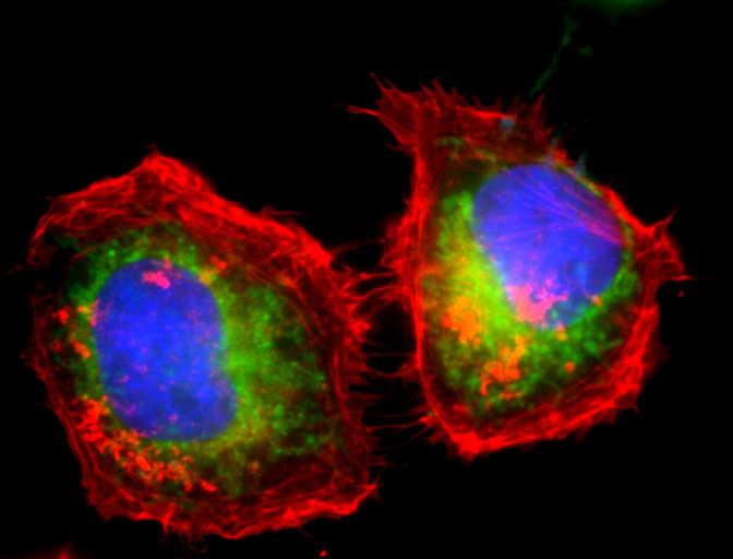 MitoSpy(TM) Green FM Reactivity: Human, Mouse, Rat, All Species Size: 5 x 50 ug
