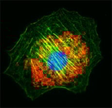 MitoSpy(TM) Red CMXRos Reactivity: Human, Mouse, Rat, All Species Size: 5 x 50 ug