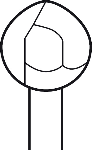 Fraise Twin Cut ELAN 4 pour pièce à main 2 anneaux - Ø 8,0 mm