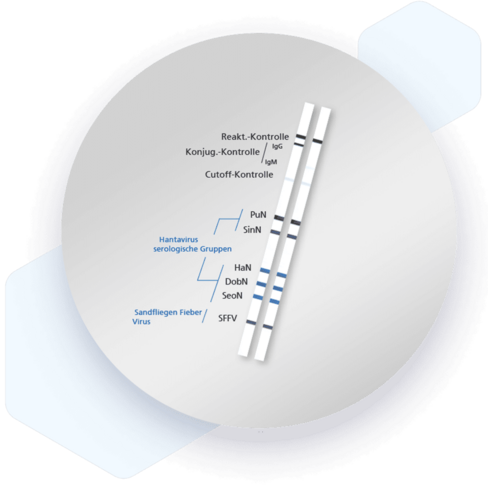 RecomLine HantaPlus IgM