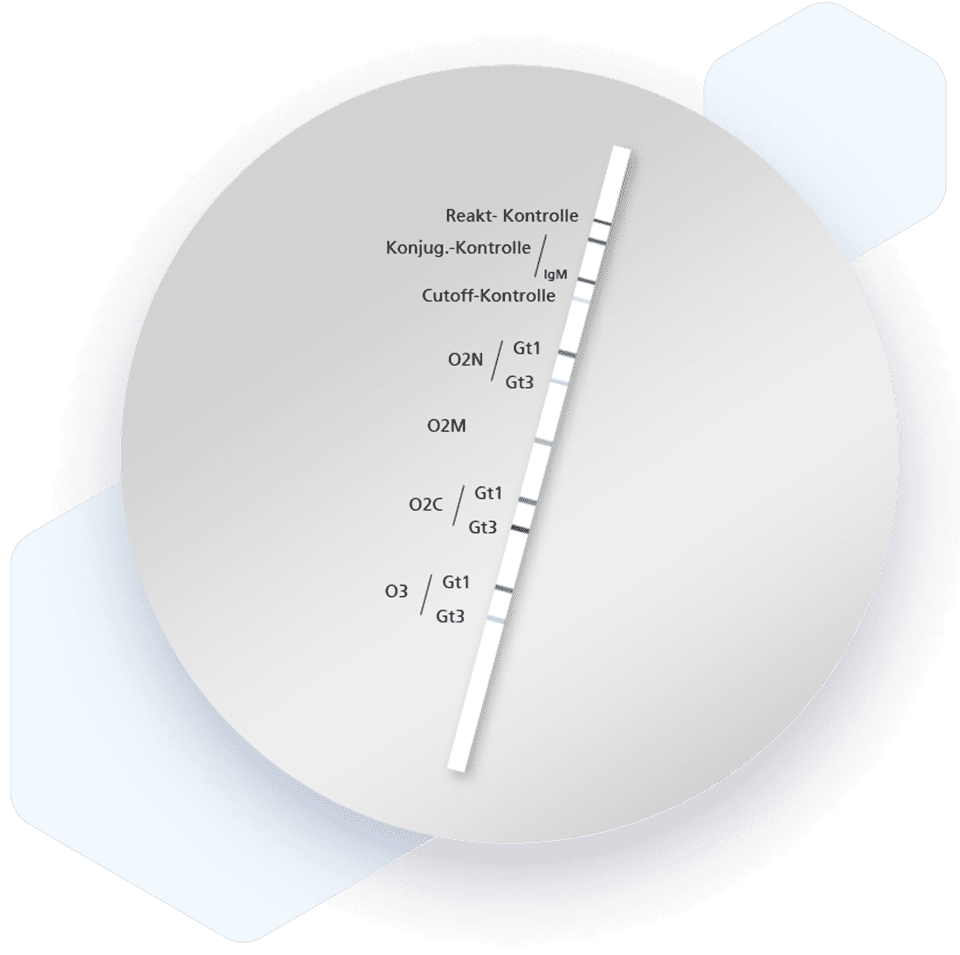 RecomLine HEV IgG/IgM