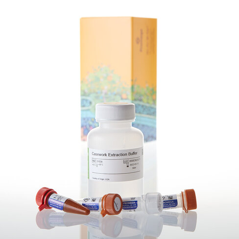 Casework Extraction Kit, 100 rxn