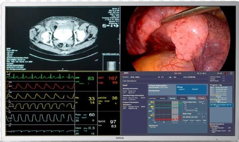 Moniteur 4K 55'' avec décodeur intégré nexxis/matrix