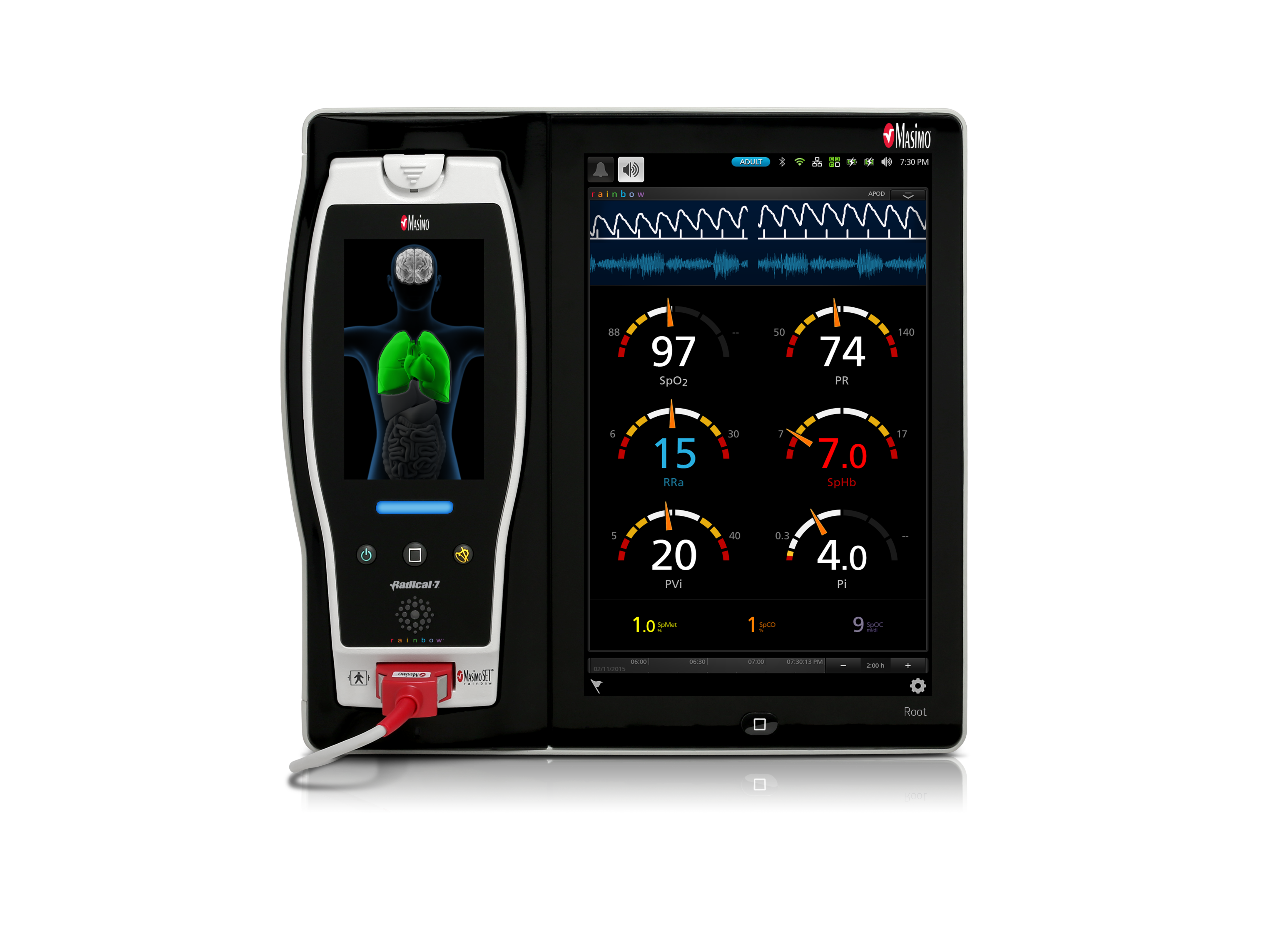 Moniteur Radical-7 [SpO2, RRp, SpHb, PVI] sur station ROOT