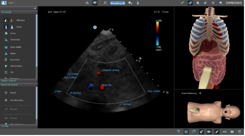 Echographie Neuro-fœtal