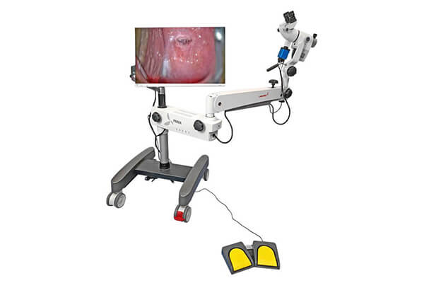 Colposcope LABOMED Prima CS - Voir la brochure PDF (Nouvelle fenêtre)